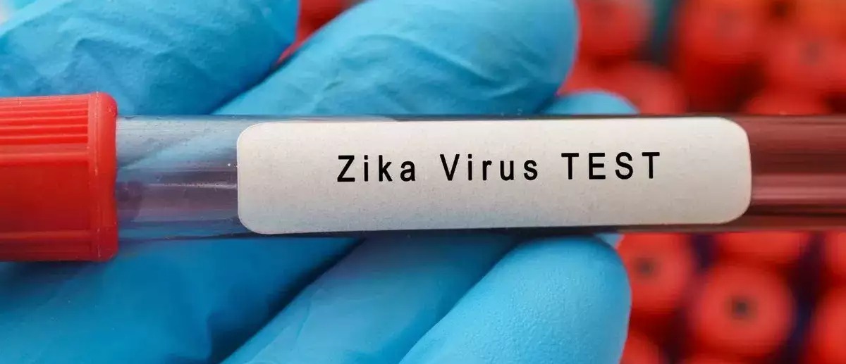 Zika virus case detected in Gujarat, patient discharged after treatment